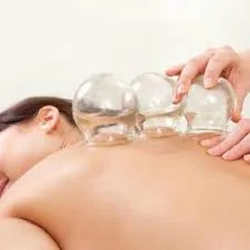 Inicio de tratamiento con ventosas o cupping con Asianhealth