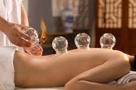 Cupping_terapia_con_ventosas de manera artesanal