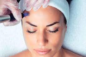 Dermapen Facial Mujer