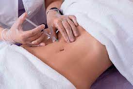 Mesoterapia Abdomen y cintura